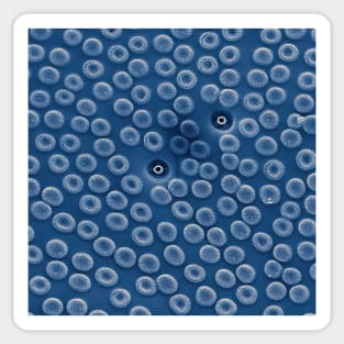 Diatom - Cyclostephanos from Lake Malawi (blue) Sticker